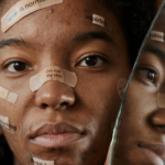 What health problems can acne create