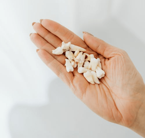 What does it mean when you dream that your teeth are falling out?